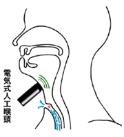 図：電気式人工喉頭