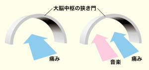 図(5) 痛みのゲートコントロール理論