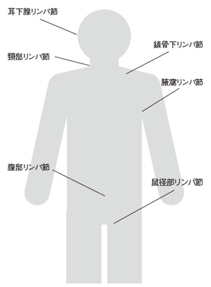 図：主なリンパ節と悪性リンパ腫の症状