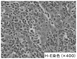 H-E染色（×400）