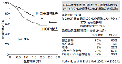 びまん性大細胞型B細胞リンパ腫に対するR-CHOP療法の効果