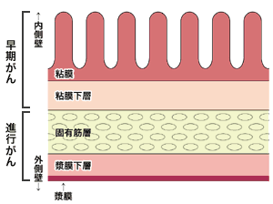 図：胃壁の構造
