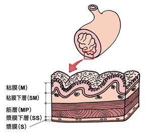 図：胃の壁の構造