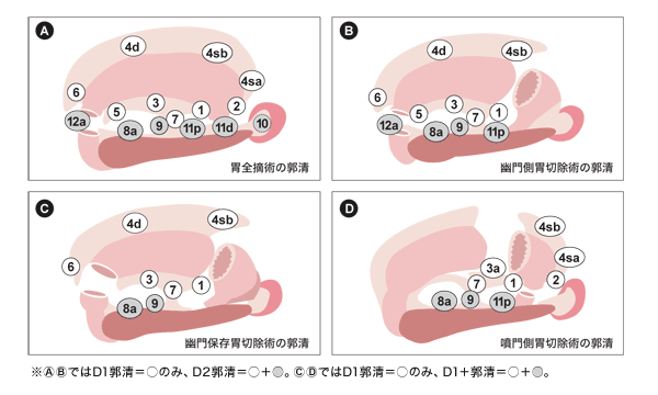 図:リンパ節郭清範囲の定義(案)