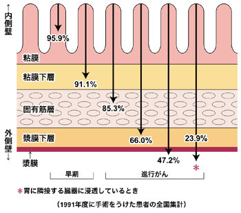 図:がんの深達度と5年生存率の関係