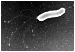 ピロリ菌の顕微鏡写真