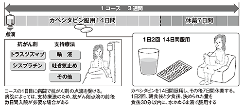 図4 トラスツズマブを用いた治療スケジュール
