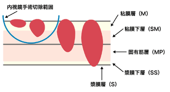 胃壁の構造図