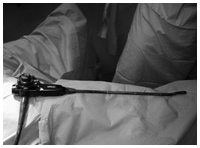 写真：腹腔鏡手術に用いる道具の中心になるカメラ