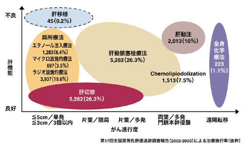 図:肝細胞がんに対する治療法の選択