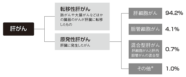 肝がんの種類