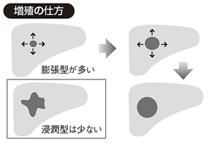 増殖の仕方