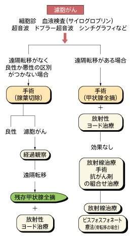 甲状腺がんの治療ガイドライン（濾胞がん）