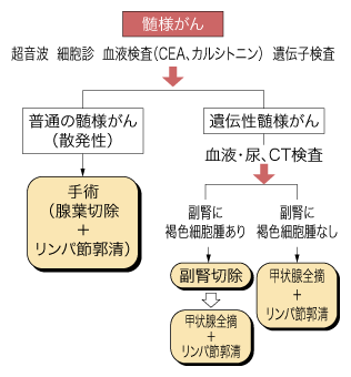 甲状腺がんの治療ガイドライン（髄様がん）