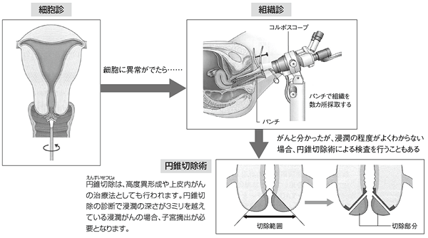 どんな検診をするの