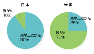 食道がんの日米種別比較