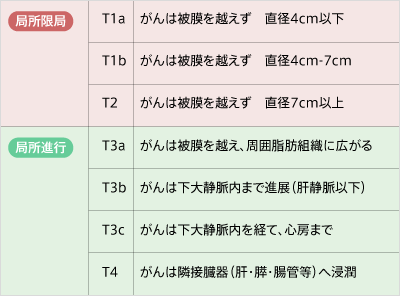 腎臓がんの局所深達度と病期