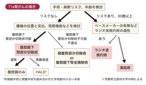図：T1a腎がんの場合