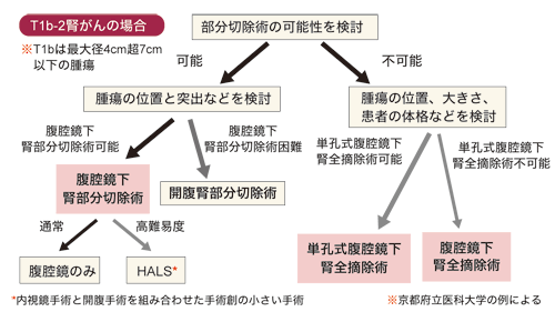 図：T1b-2腎がんの場合