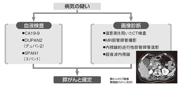 膵がんではどんな検査をするの
