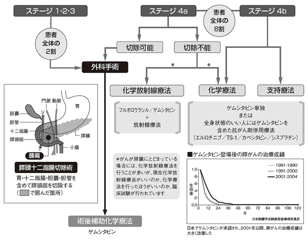 膵がんの治療とは