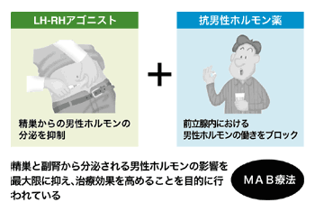 図:ホルモン併用療法(MAB療法)の組み合わせ