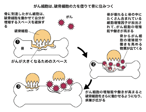 図:骨転移が起こる仕組み
