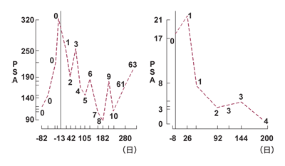 図：ドセタキセル投与後のPSAフレア現象