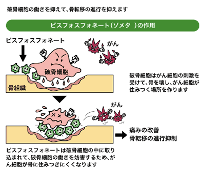 図:骨転移の進行を抑えるビスフォスフォネート