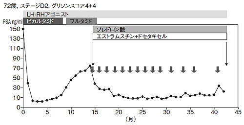 図5 ゾレドロン酸とドセタキセルによる治療が成功した症例