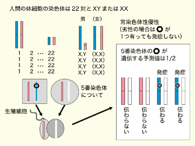 図：家族性の大腸がんが遺伝する仕方