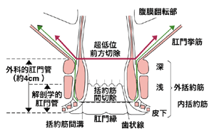 図：肛門管と肛門��存術の方法