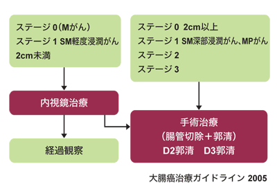 図:ステージ1~3の治療法選択方針