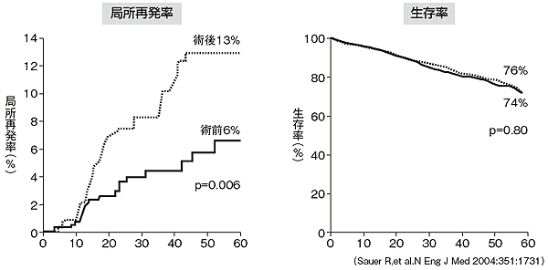 化学放射線療法は術前と術後どちらに行うほうがいいか