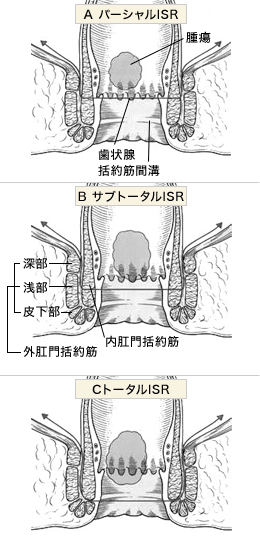 図:術式分類