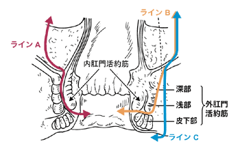 図：下部直腸がんの切除方式