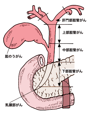 図：胆管がんの発生部位