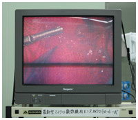 術野はモニターで映し出される