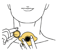 図:ヴォイスプロテーゼの装着の仕方