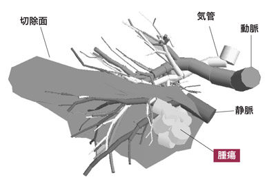 図：切除面を目立たせた画像