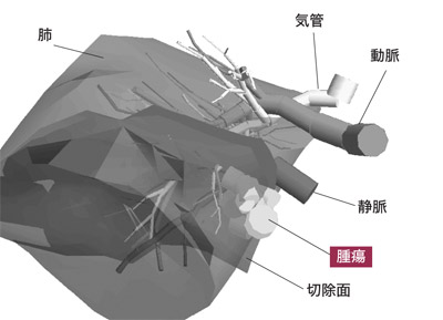 図：切除面を含む肺の画像