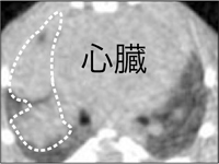 ALK阻害剤投与前
