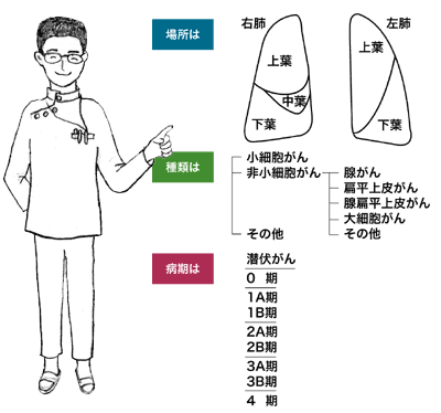 図：あなたの肺がんは？