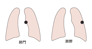 図：肺門部と肺野