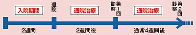 図6 ゲフィチニブの投与計画