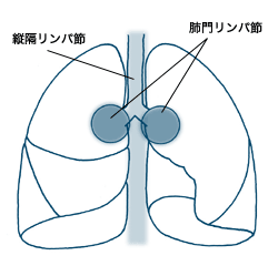 図:縦隔リンパ節の範囲
