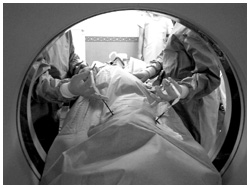 写真：正確に腫瘍の中心部へ誘導針を刺し入れることが、治療の成否を決める凍結療法