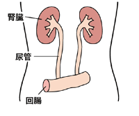 図:回腸導管