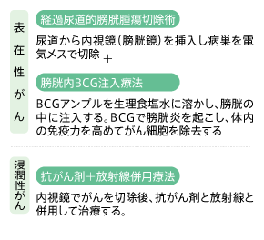膀胱を温存する治療法