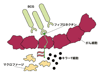 図：BCG膀胱内注入療法が効果を出すメカニズム